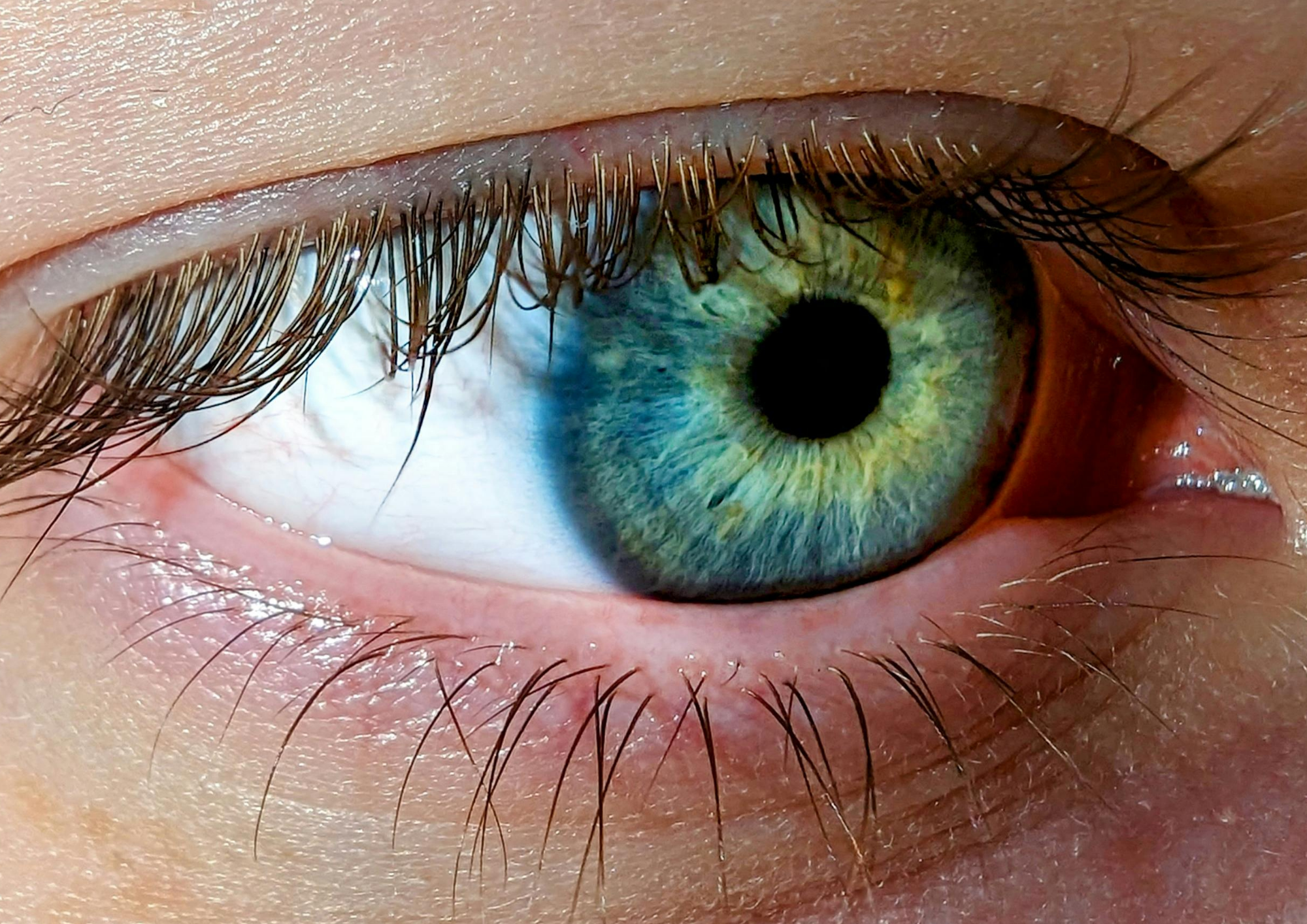 Why an Eye Exam Is More Than a Vision Check